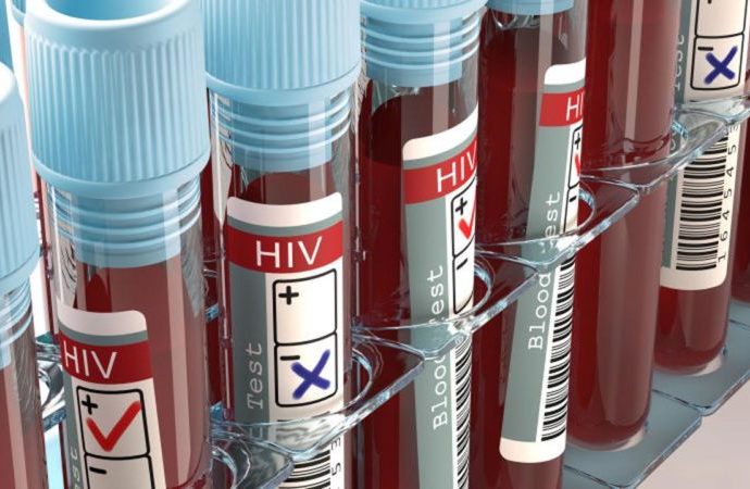 HIV/AIDS: We Are Alive To Our Responsibilities – OSACA