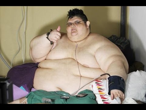 World’s Fattest Man Ready for Surgery
