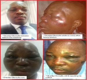 Assaulted Journalist Tells Court How He Was Brutalised At Seme Customs Command