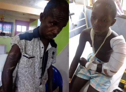15-year-old Boy And His Father Brutally Attacked With Machete In Delta State