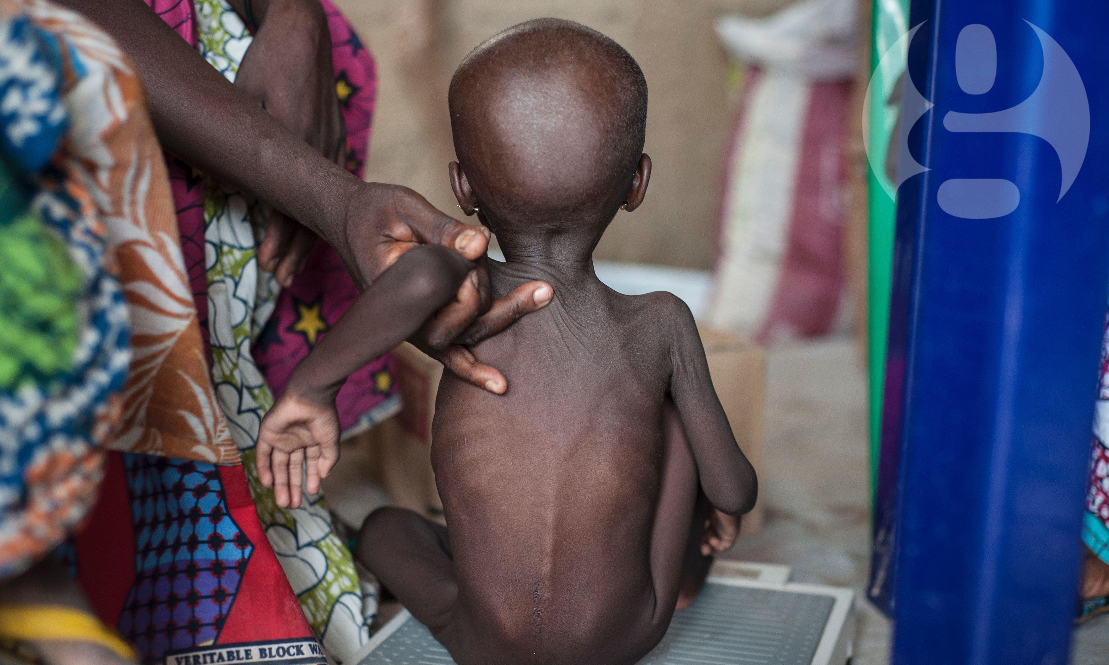 Famine Response And Prevention In Northeastern Nigeria