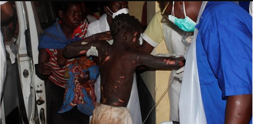 Kerosene Explosion Kills One In Akwa Ibom