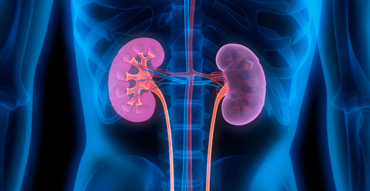 Women Are More At Risk Of Developing Chronic Kidney Disease