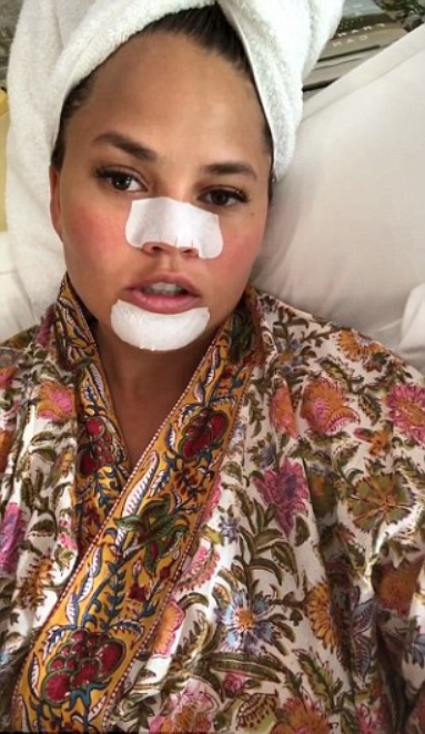 Chrissy Teigen Shares Unflattering Double Chin Selfie