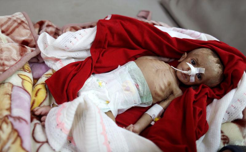 Famine Threatens 14m People In Yemen