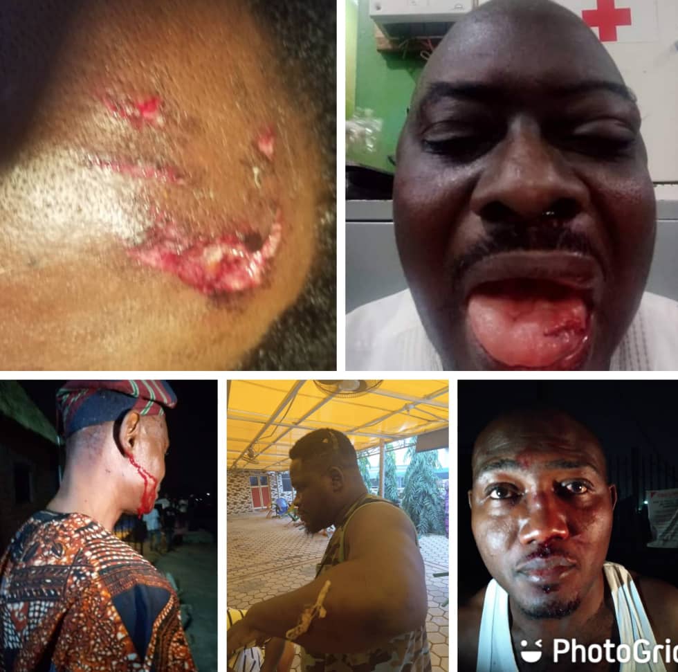 How I Escaped Assassination Attempt – Aregbesola’s Aide Says Assailants Attacked Hon BFK, 4 Others