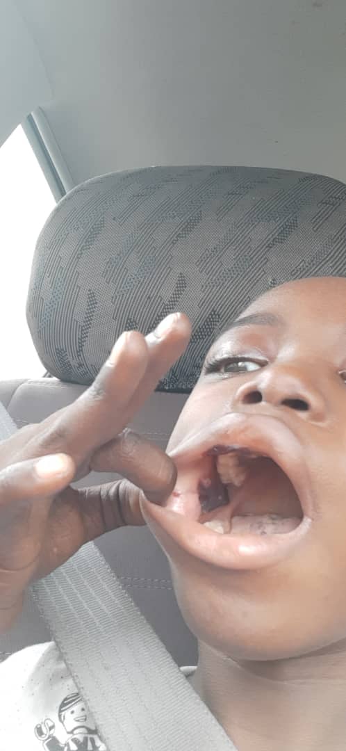 S.O.S: 8-Year Old Samad Needs Help To Treat Aplastic Anemia