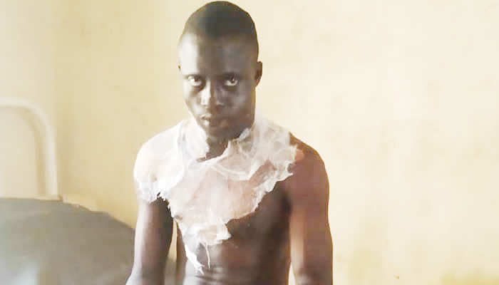Married Man Sets Himself Ablaze Over Abusive Wife In Osun