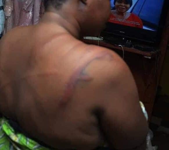 Woman Brutalised By Police In Osun Says She’s Yet To Be Compensated 2-Yr After