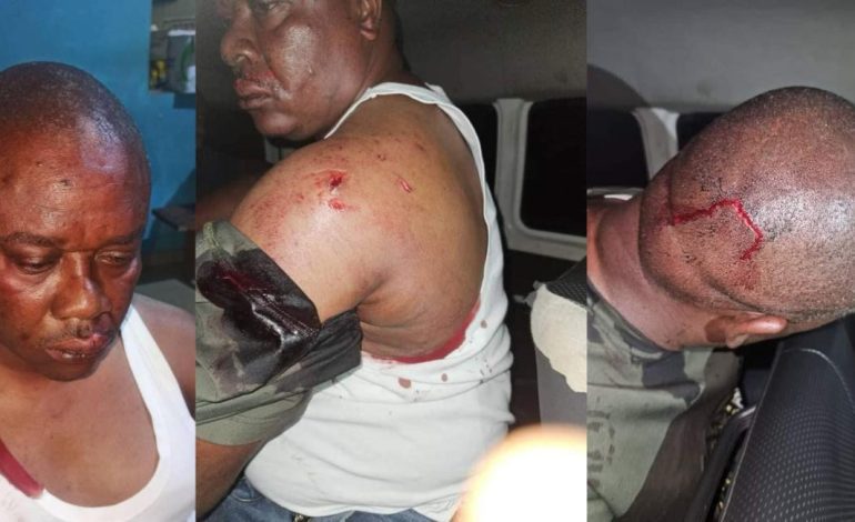 Bayelsa: Thugs Attack Council Chairman Over Election Materials