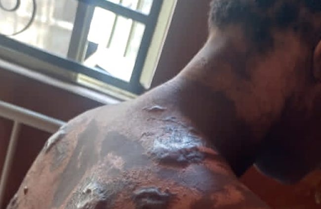 Landlady Bathes Tenant With Hot Water Over Rent Increment