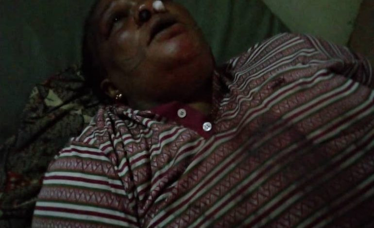 Suspected Political Thugs Attack APC Women Leader