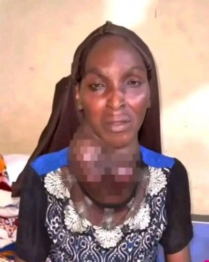 Woman Who Chose N300,000 Cash Over Surgery To Remove Goitre Dies