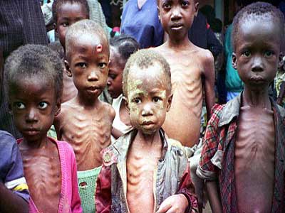Economic Hardship: Children At Risk Of Low Immune System, Stunted Growth – Expert Warns 